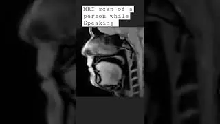 MRI scan when speaking #speaking #tongue #speech #scan #human #face #nose #views