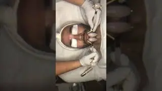 CBD Facial