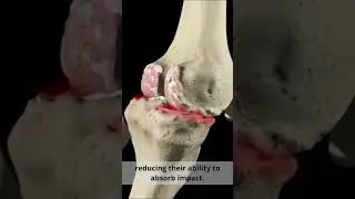 Shock-Absorbing Blade: Skate the Future ⛸️☁️