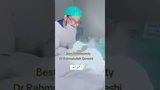#best #ent #doctor #peshawar #bannu #pakistan #kpk #rhinoplastysurgeon #septoplasty #best #beauty