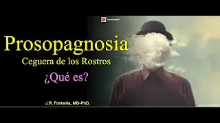 Ceguera de los Rostros. Prosopagnosia.