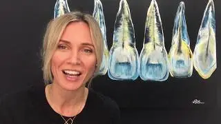 Myth: Dental implants are painful