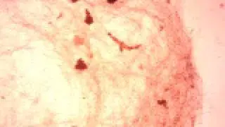 Microthrix parvicella en bioreactor