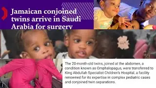 Saudi Arabia 🇸🇦 Welcomes Jamaican Conjoined Twins To Perform Surgery Free Of Cost 🙏🏻🙏🏻 #godisgood 