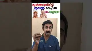 മുൾത്താണിമീട്ടി മുഖത്ത് തേച്ചാൽ മുഖം വെളുക്കുമോ ? Multani mitti Face pack Benefits