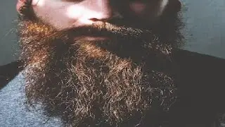 why does my beard stop growing at a certain length