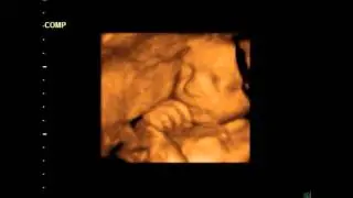 Beautiful Happy Baby 4d Ultrasound