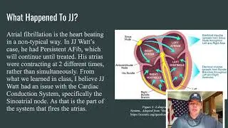 BI117 Extra Credit #1 JJ WATT