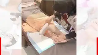 Leg Scar⚡️Laser Treatment