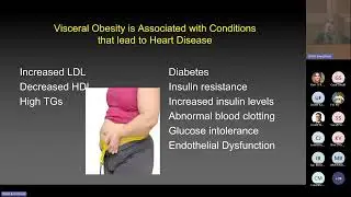 Menopause and Cardiovascular Health: Decision Making in the Woman at Risk, with Beth L. Abramson, MD