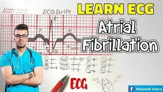 معلومات بغاية الاهمية حول الرجفان الأذيني السريع و الغير منتظم Learn ECG! Atrial Fibrillation