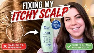 I Fixed My Itchy Scalp Using LabMuffinBeauty&rsquo;s Routine