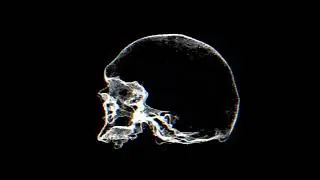 [81 Bpm] $uicideBoy$ x Freddie Dredd Type Beat - BeastBlood