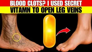 Seniors, This Vitamin DISSOLVES Blood Clots in Legs! (Big Pharma HID It!)  | Senior Health Tips