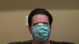 Hair line restoration surgery to treat receding hair line  by Dr. Diep San Jose, Ca