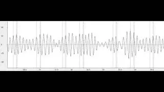 Application of Kalman filtering for estimating neural oscillations