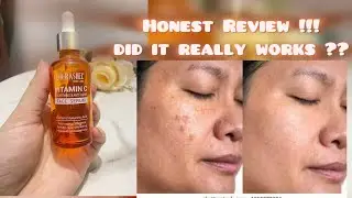 Dr rashel Vitamin C serum Honest Review 🎀✌🏻