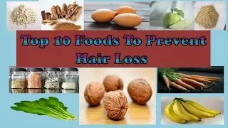 Top 10 Foods To Prevent Hair Loss #hairloss #preventhairloss