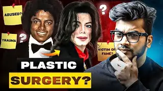 How MICHAEL JACKSON Change From Black To White ?