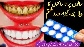 🔴This remedy will make your yellow and dirty teeth shine like pearls for 50 years😱Teeth whitenin...