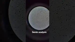 SEMIN ANALYSIS UNDER MICROSCOPE #biology #science