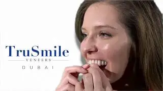 TruSmile Veneers