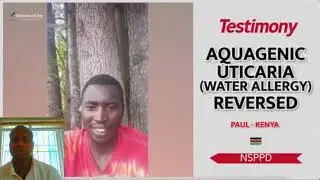 You Won't Believe This Man Was Allergic To Water - Nsspd 7am Fire Prayers Testimonies