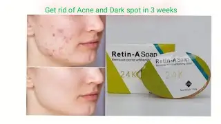 This cheap soap works better than expensive brands