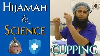 Cupping Benefits (What Science Says) by Dr. Iftikhar Ahmad Saifi