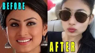 Top 10 TV Actresses Who Opted For Plastic Surgery | BEFORE & AFTER | TV Prime Time