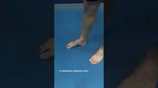 HALLUX VALGUS - Упражнения для большого пальца стопы🦶