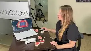 Стоматологічний сканер Eighteeth Helios 600