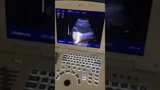 Portable black & white ultrasound machine with high quality