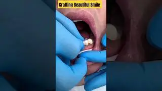 Crafting Beautiful Smile