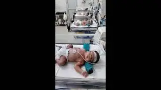 Icu and. Nicu care and treatment in NICU picu NICU