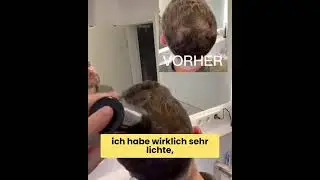 Die ultimative Sofortl&ouml;sung bei Haarausfall!