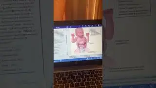 USMLE UWorld STEP 1: Как подготовиться к USMLE Step 1 с помощью UWorld в 2026 году