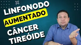 CÂNCER DE TIREÓIDE- todo gânglio (linfonodo ) aumentado é câncer ?