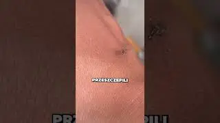 Genetycznie Zmutowany Komar! (u/aseriousgirl)