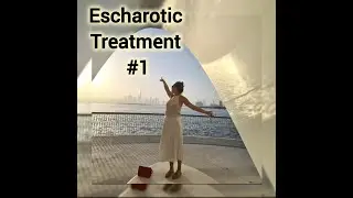 HPV - ESCHAROTIC TREATMENT#1: Fear, anxiety and relief- CERVICAL DYSPLASIA