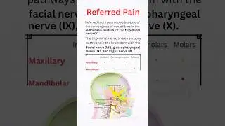 Referred Dental Pain: The Surprising Link Between Teeth and Other Areas #shorts #dentostudy