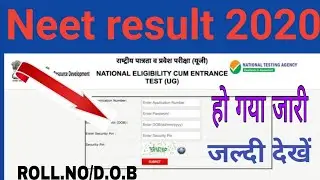NEET result Declared 2020🔴 Live
