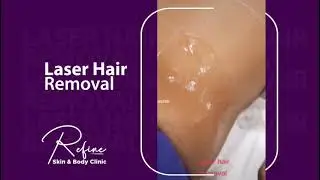 Refine Skin & Body Clinic - Laser Hair Removal
