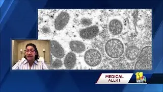 Medical Alert: Monkeypox continues to spread even here in Maryland