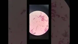 #song#microscope#medicalstudent#world #viralvideo#love#whatsappstatus#music#viral#motivation#student
