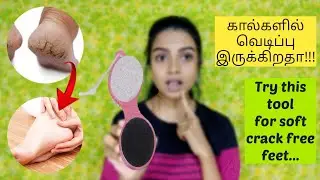 💥💥 HOW TO🤔 REDUCES😯 CRACKS ON 😃FEET IN TAMIL ❤️ || EBINA GIFTLIN