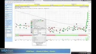 Friday Chart Clinic KLSE Investor - 4 Sep 2015
