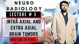 Difference b/w Intra-axial & Extra-axial Brain Tumors | Intra axial Brain Tumor | Extra axial Tumor