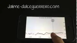 Dexcom G5
