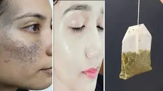 Eliminate Pigmentation, Melasma, Black Spots and Discoloration.